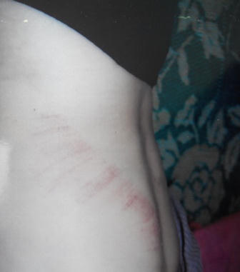 Phó công an phường bị tố hành hung khiến bạn vợ nhập viện